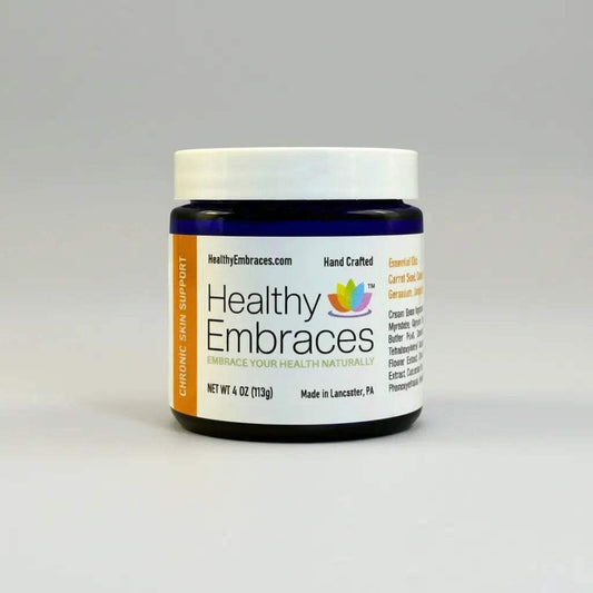 Healthy Embraces Chronic Skin Support Cream in a 4oz jar, showing the creamy texture and label for long-term skin condition relief.