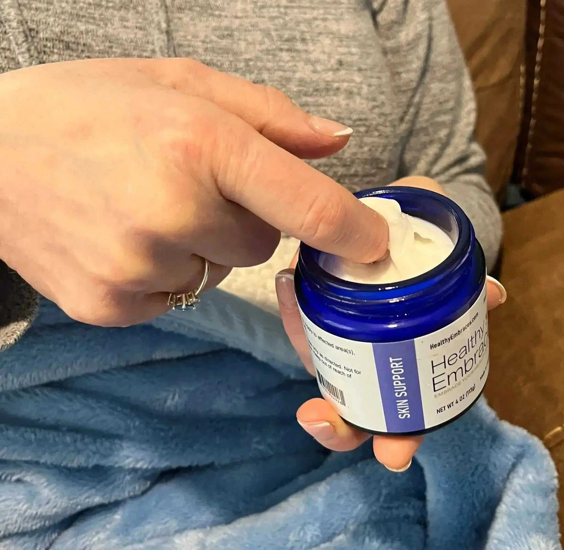 Healthy Embraces Skin Support Cream in a 4oz jar, designed to support dry flaky skin.